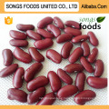 Kidney Beans Production Dark Red Kidney Beans